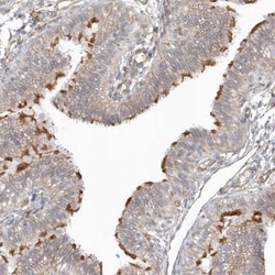 DNAH1 Antibody, Novus Biologicals 25 &mu;L; Unlabeled:Antibodies, Polyclonal
